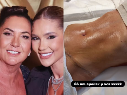 Mãe de Virginia impressiona ao exibir barriga chapada após cirurgias plásticas