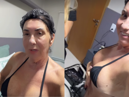Mãe de Virginia exibe corpo após 30 dias de cirurgias e comemora com novo procedimento