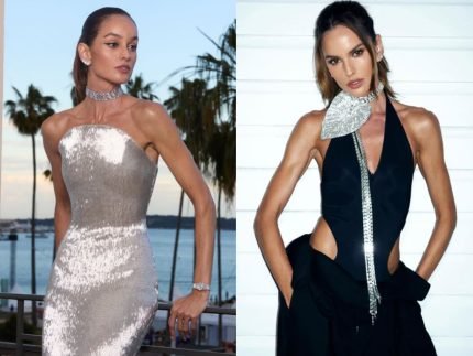Izabel Goulart surge com rosto diferente após suposto procedimento e web reage