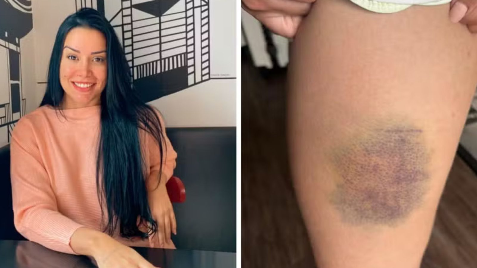 Nutricionista que escapou de tentativa de estupro revela que usou jiu-jítsu e 'mata-leão'